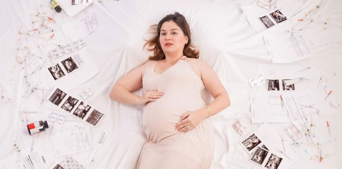 Nadine Samonte: "Lahat ng injections, bills, reseta, gamot—the reality of having APAS and PCOS"