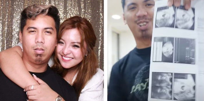 LOOK: Vloggers Cong TV at Viy Cortez, magkaka-baby na!