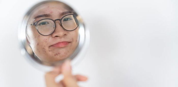 Mom confession: "Nakakasakit ng damdamin na masabihan ng LOSYANG"