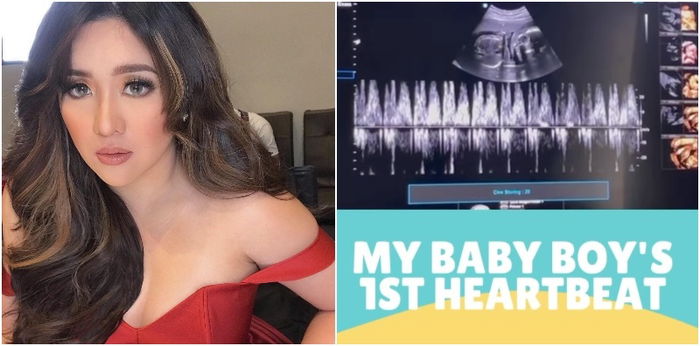 Angeline Quinto sa kaniyang 3rd ultrasound: “Dito ko unang narinig 'yong heartbeat ni baby”