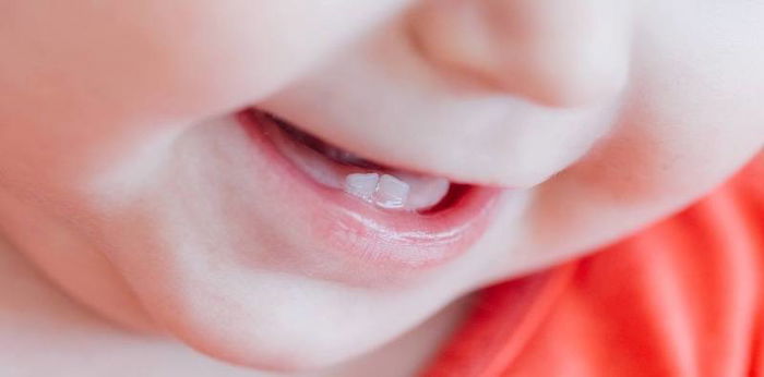 Delayed tooth eruption: When to worry about baby teeth not coming in