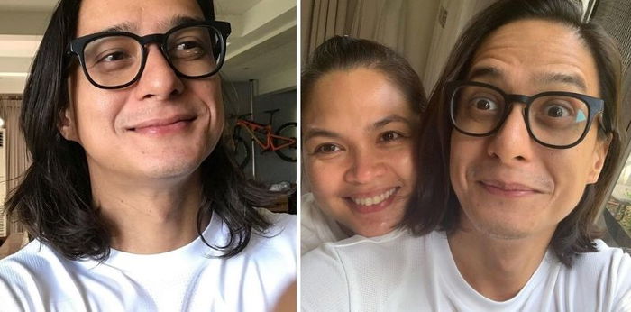 Ryan Agoncillo binahagi ang laban sa alopecia: "May mga pelikula dati na kaya mahaba 'yong buhok ko. Tinatakpan ko 'yong bald spot"