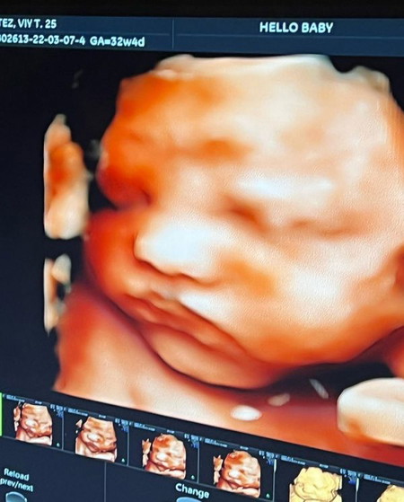 viy cortez pregnancy