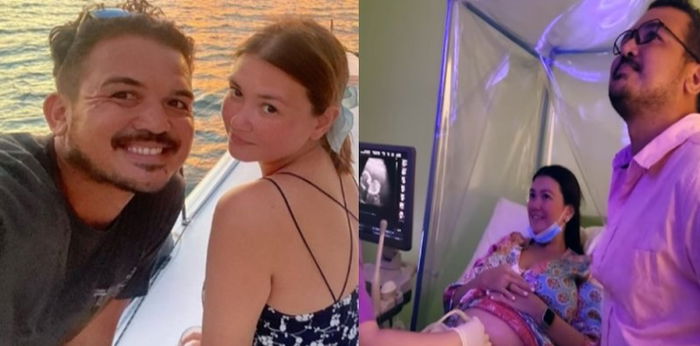 Boyfriend ni Angelica Panganiban, naiyak nang makita ang first ultrasound ng kanilang baby