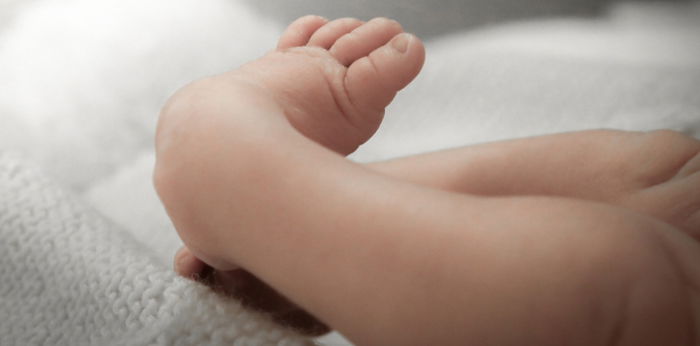 Clubfoot in babies: 5 symptoms of clubfoot that may affect your child