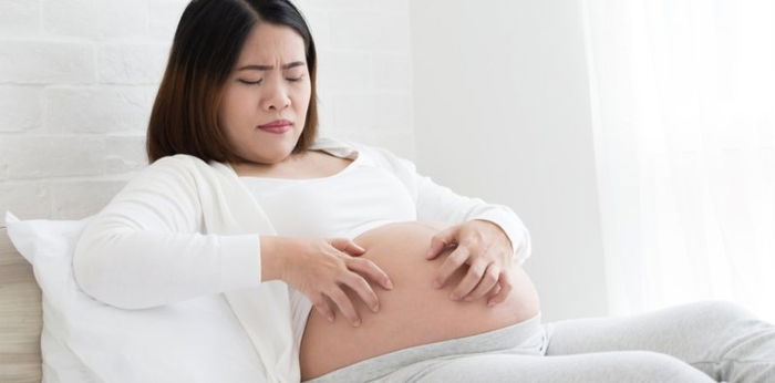 Itchy rash on the belly in your last trimester? It could be Pruritic Urticarial Papules and Plaques of Pregnancy(PUPPP)