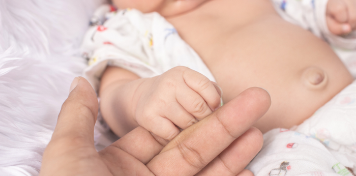 Umbilical hernia in babies: Causes, symptoms, and treatment