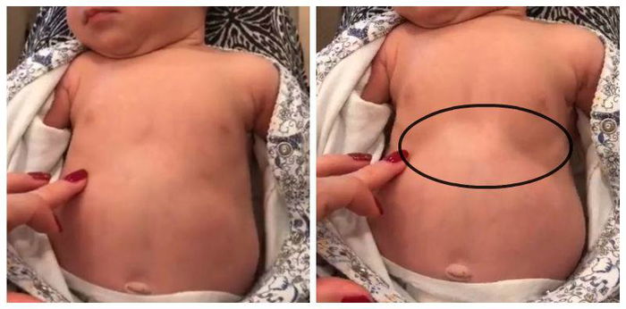 Moms, watch out for this sign of breathing difficulty in babies