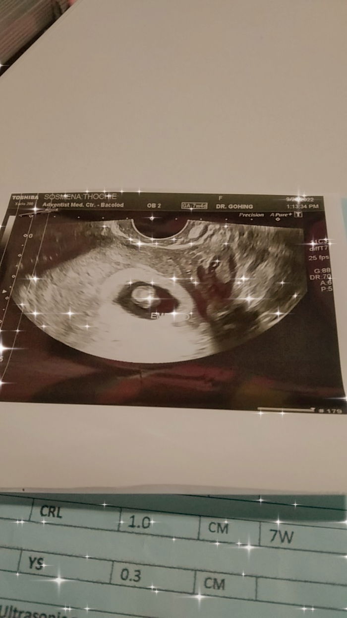 PCOS Warrior - A Fight against PCOS