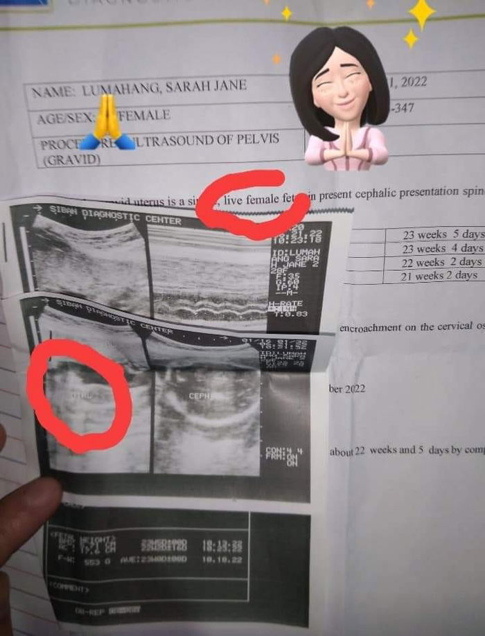 It's a girl again (my 3rd pregnancy)