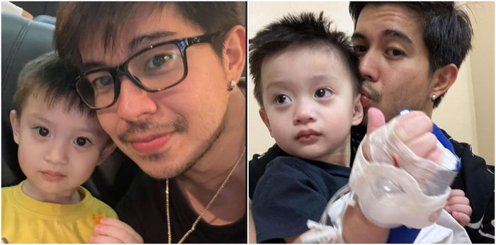Anak ni Rodjun Cruz na-dengue! Anu-ano ba ang sintomas ng sakit na ito?