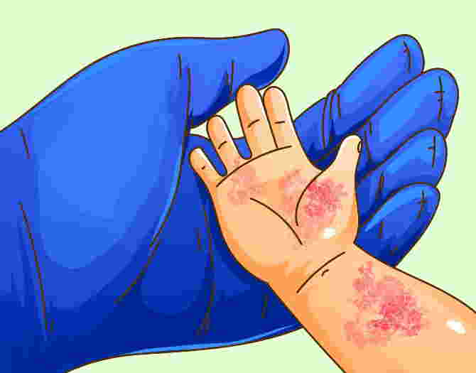Itchy skin? 8 possible causes of your skin itching
