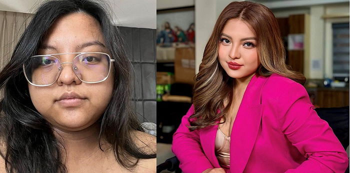 Viy Cortez from 94kg to 60kg weight loss: “Kahit ano inumin nyo kung walang disiplina sa pagkain wala po mangyayare”