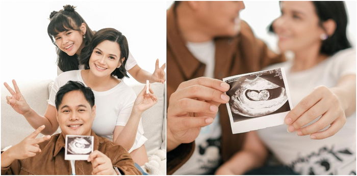 LOOK! Yasmien Kurdi buntis sa kaniyaang 2nd baby