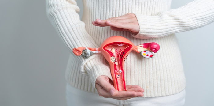 5 dahilan kung bakit nagkakaroon ng PCOS ang isang babae