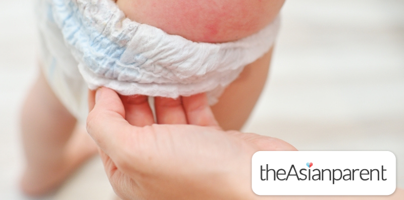 How to Get Rid of a Diaper Rash in 24 Hours: Fast and Safe Remedies for Babies