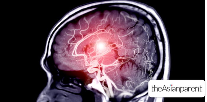 Familial Brain Aneurysms: What You Need to Know About Risk and Prevention