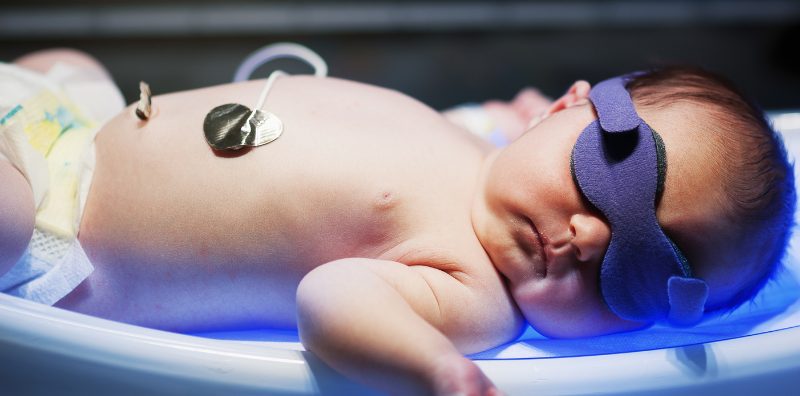 Newborn Jaundice: Normal Levels, How to Spot It, and Treatment Methods