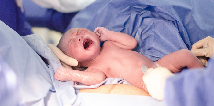 Is It Safe to Have a C-Section at 37 Weeks? Is 37 Weeks Considered Full Term?