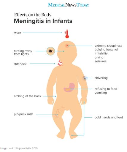 Source:https://www.medicalnewstoday.com/articles/324726#symptoms-in-adults 