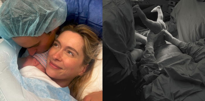 Mother-Assisted C-Section: Bringing Moms Closer to Their Babies from the First Moment