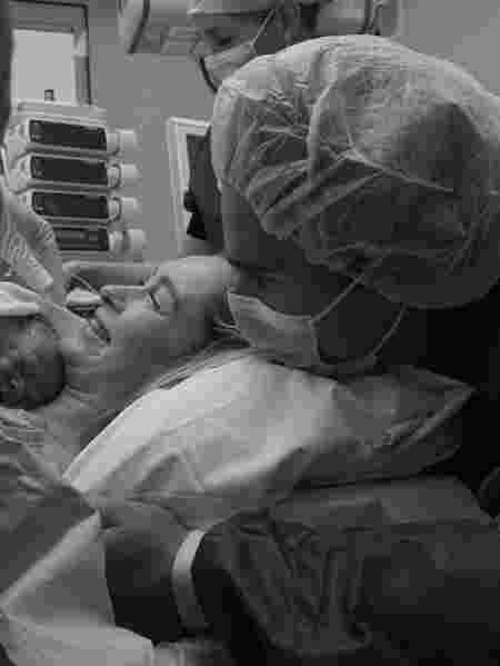 mother assisted c-section