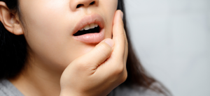 Sakit ng Ngipin Habang Buntis: Ligtas na Gamot at Tips Para Mawala ang Toothache