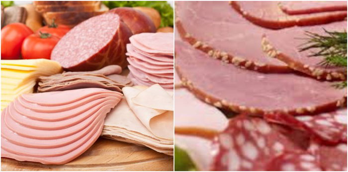 Pregnancy Questions: Can I Eat Deli Meat?