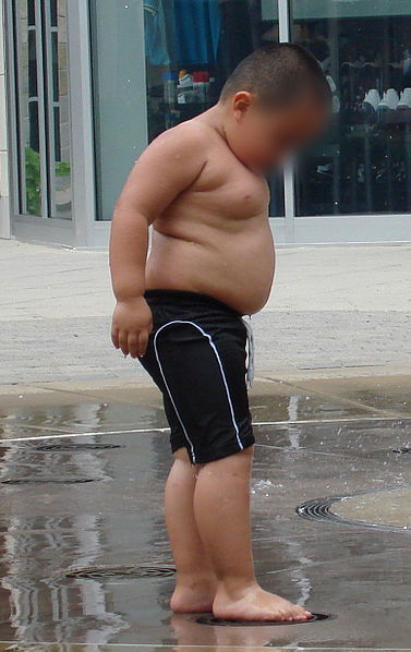 Obese Child Weighs Over 40 Kilos