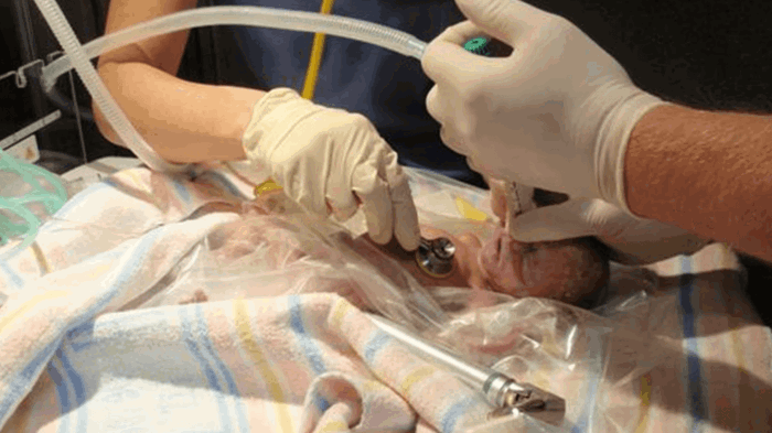 A Mums Touch Brings Baby Back To Life
