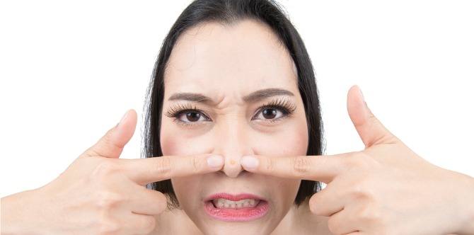 Blackheads: What Are They And How To Get Rid Of Them