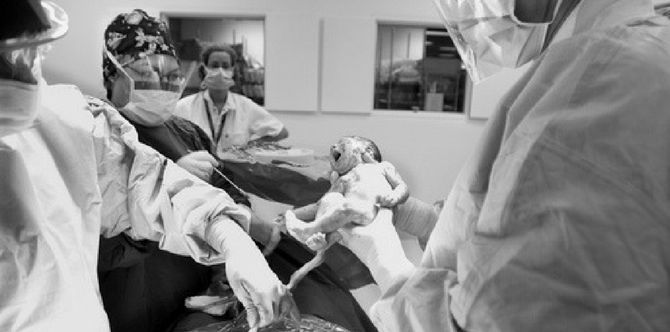 Pregnant jaywalker dies; baby lives through C-section