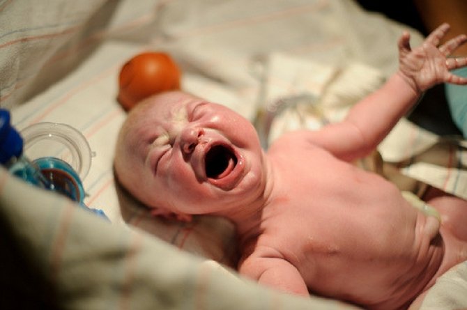 Does my child have worms?