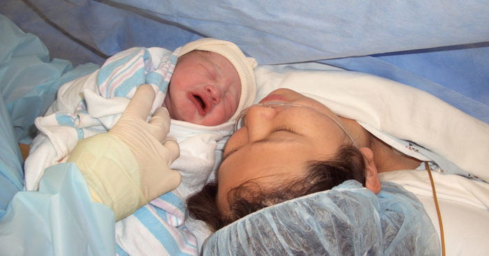 'Ask The Expert’:  Should I Choose A C-section To Avoid Delivery Pain?