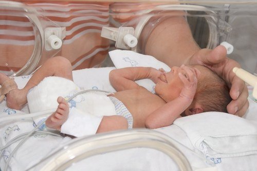 Expert tells all about premature births