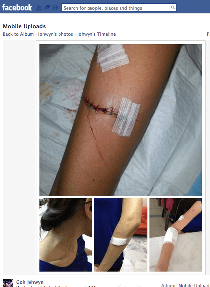 Mum carrying baby slashed by robber