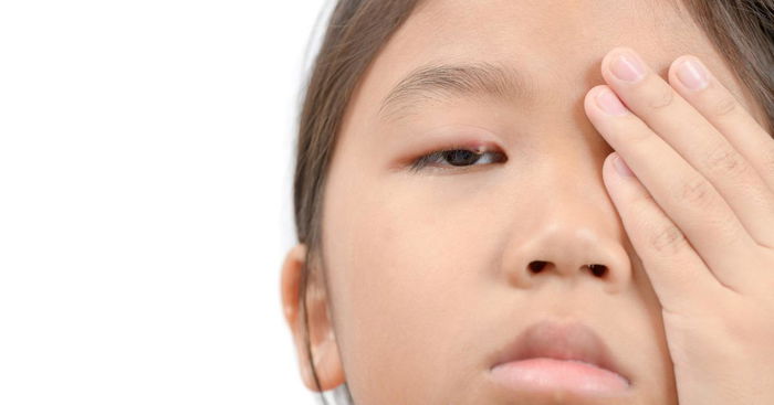 Keep an Eye Out for Eye Infection in Children