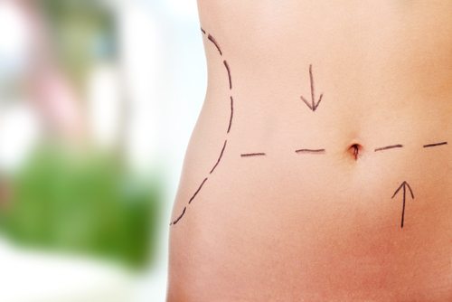 How cosmetic surgery impacts your children