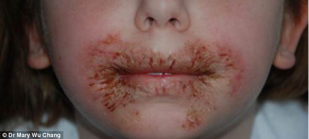 Guess what caused this horrific allergic reaction?