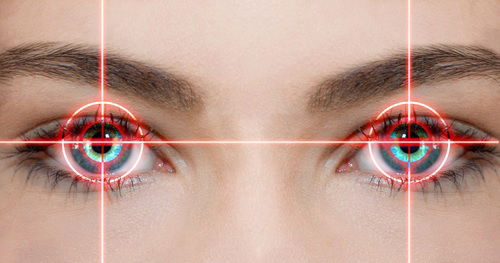 What you need to know about LASIK eye surgery