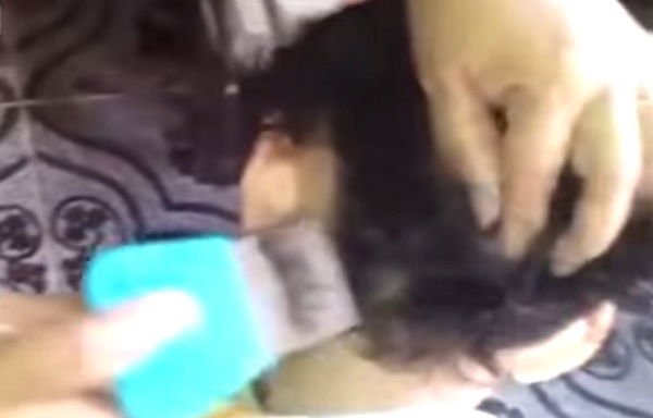 You WON'T believe the amount of head lice on this kid!