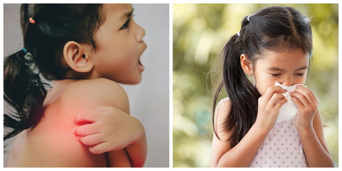 Parents' Guide on Allergies in Kids