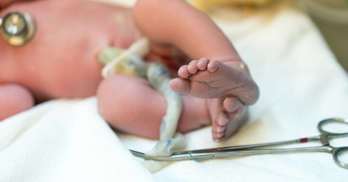 Delayed Cord Clamping: What You Need to Know and Consider In Childbirth