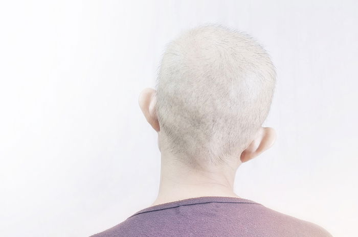 Breast Cancer Mum's Son Asks, "Why Mama Wear Fake Hair?"