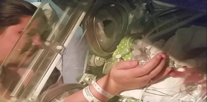 Amazing! Identical twins born apart