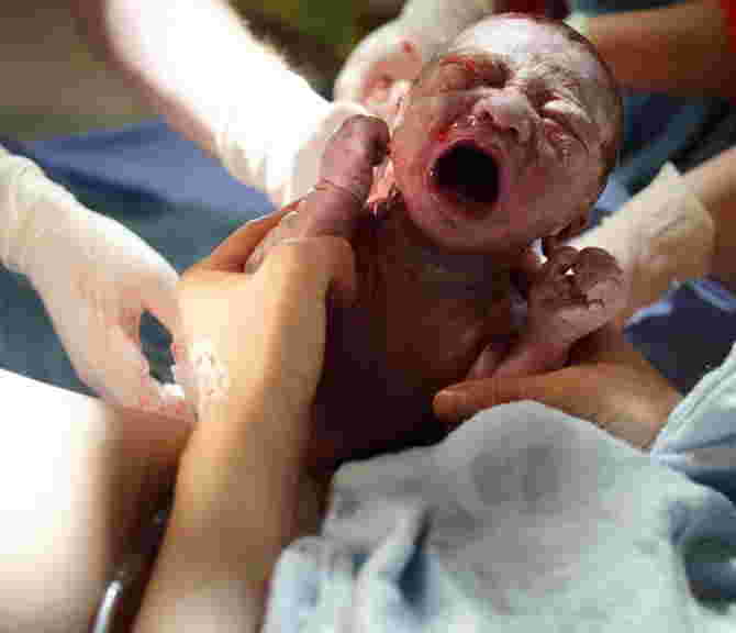 Tại sao lại có kỹ thuật Gieo hạt cho trẻ sinh mổ?