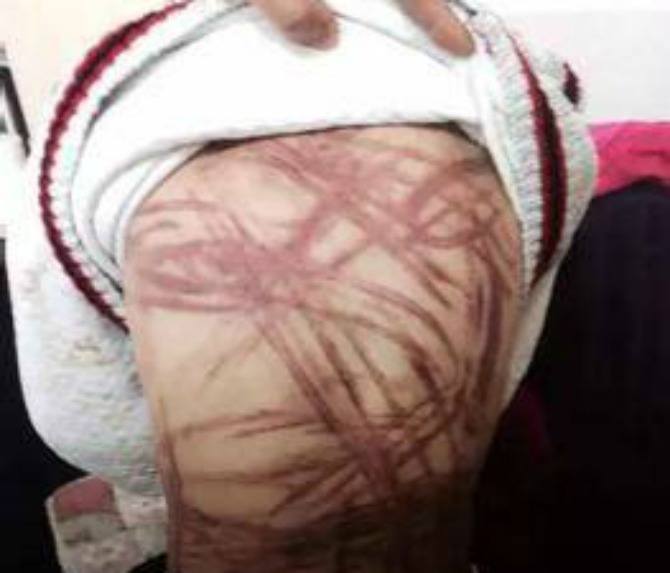 Tiger mother beat her adopted son with a skipping rope