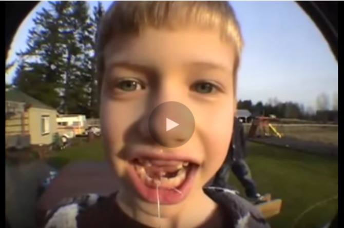 Watch: Here’s How to Pull Out A  Loose Tooth with a Rocket!