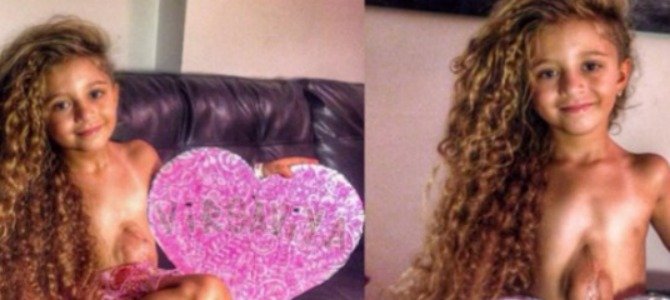 6-year-old girl’s heart beats outside her body... it’s a miracle