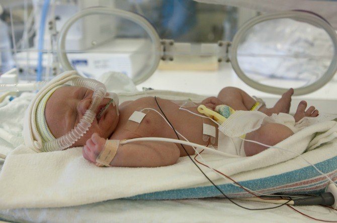 Singapore sees rise in the rate of premature births